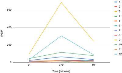 The Effects of Sampling Lateralization on Bilateral Inferior Petrosal Sinus Sampling for Pediatric Cushing’s Disease—A Single Endocrinology Centre Experience and Review of the Literature